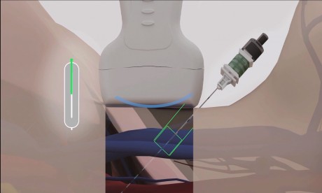 NIMOTECH - NeedlePilot