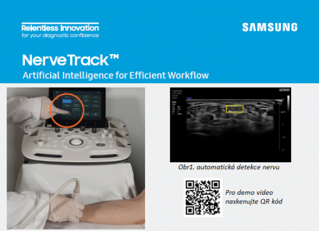 NerveTrack Technologie